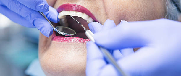 Best Emergency Dental Care for Broken or Chipped Teeth in Pulaski, VA